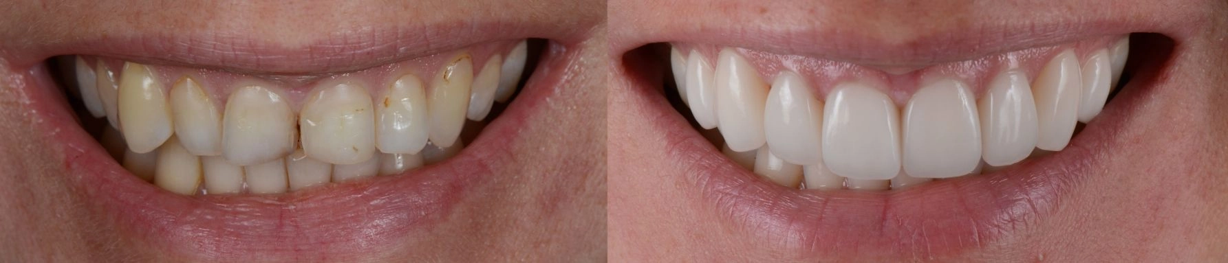 before and after picture