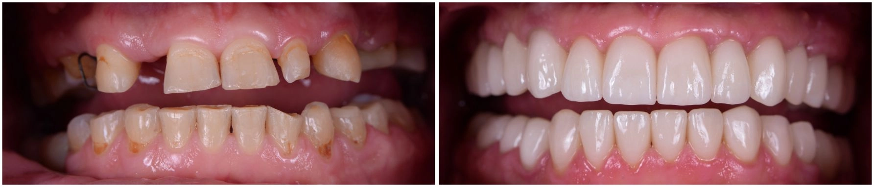 before and after picture
